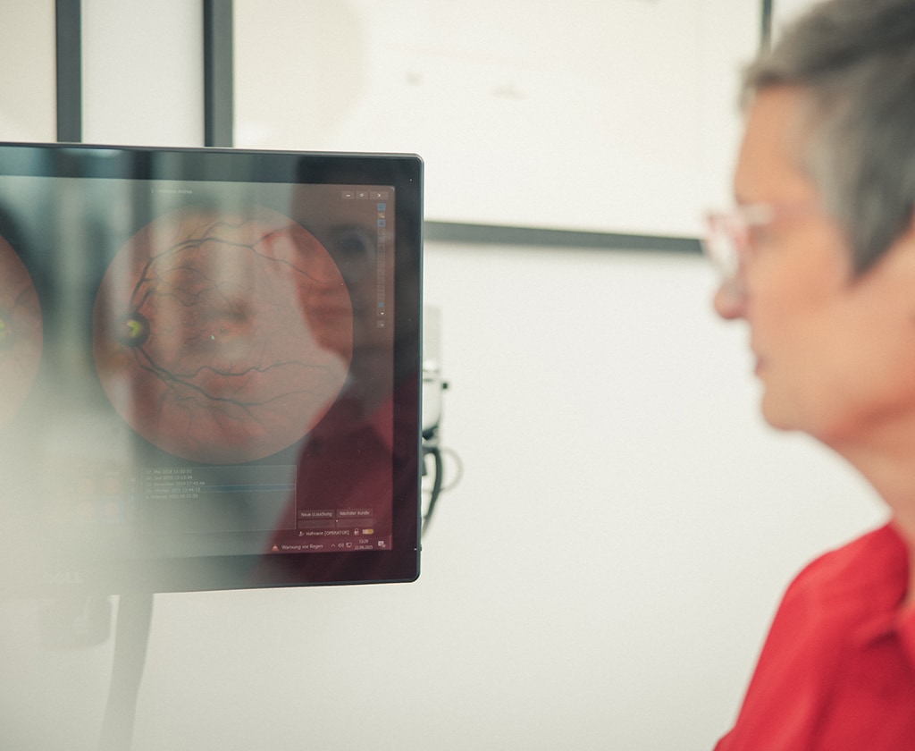 Auswertung der Netzhautbilder am Bildschirm bei Top Optik Stuttgart